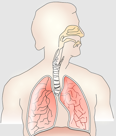 Cystic Fibrosis disease